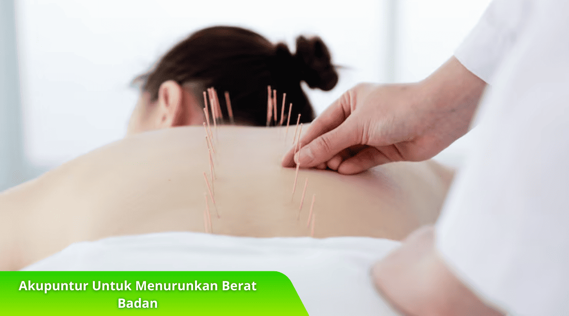 Baca! Cara Kerja Akupuntur Untuk Menurunkan Berat Badan