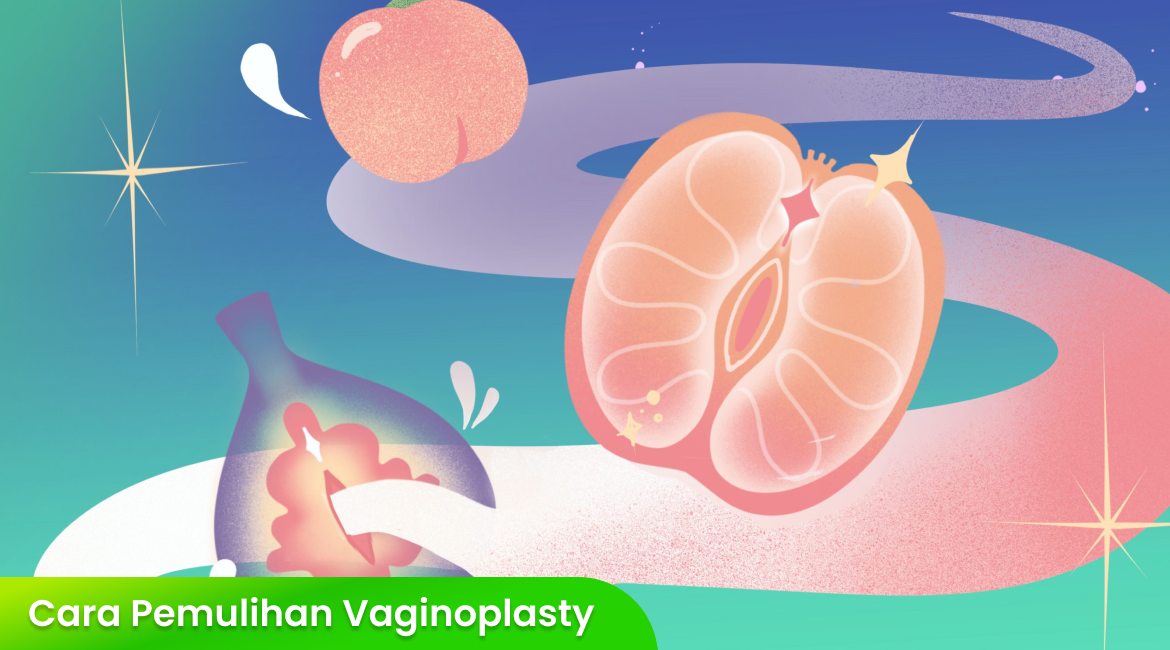 Langkah Pemulihan Vaginoplasty yang Perlu Anda Ketahui