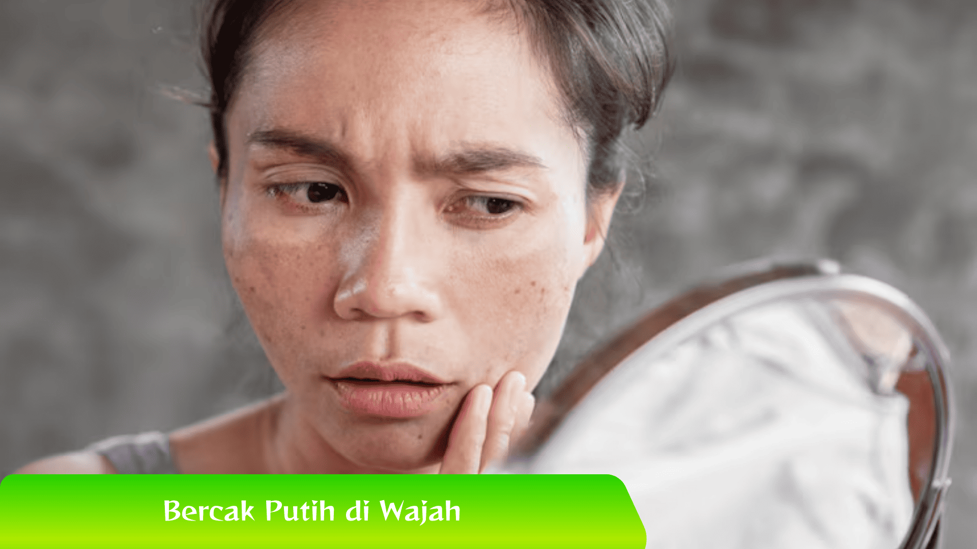 Bercak Putih di Wajah? Yuk, Simak Penjelasannya!