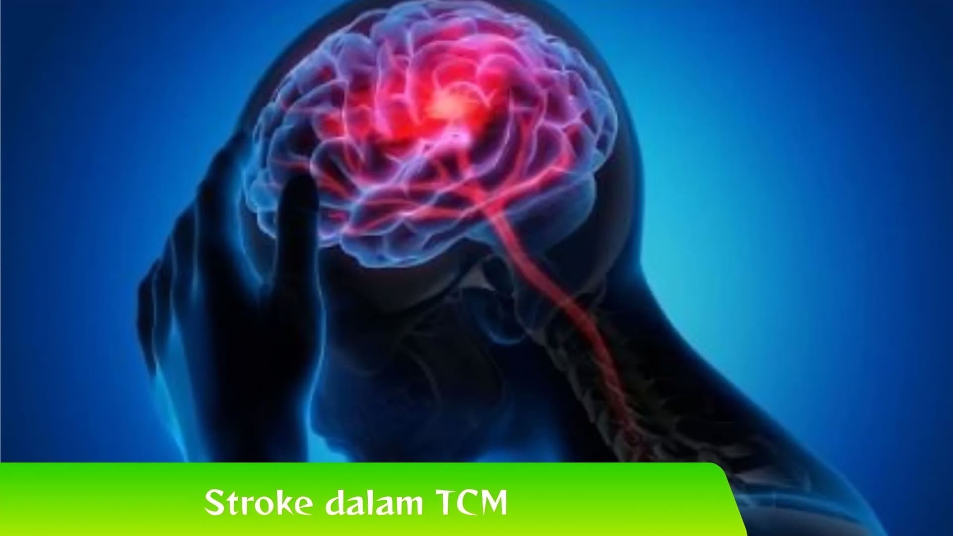 Ayo! Kenali Pengertian Stroke dalam TCM