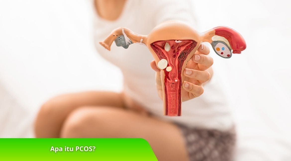 Apa itu PCOS Cermati Penyebab dan Gejalanya Disini! Apa itu PCOS? Cermati Penyebab dan Gejalanya Disini!