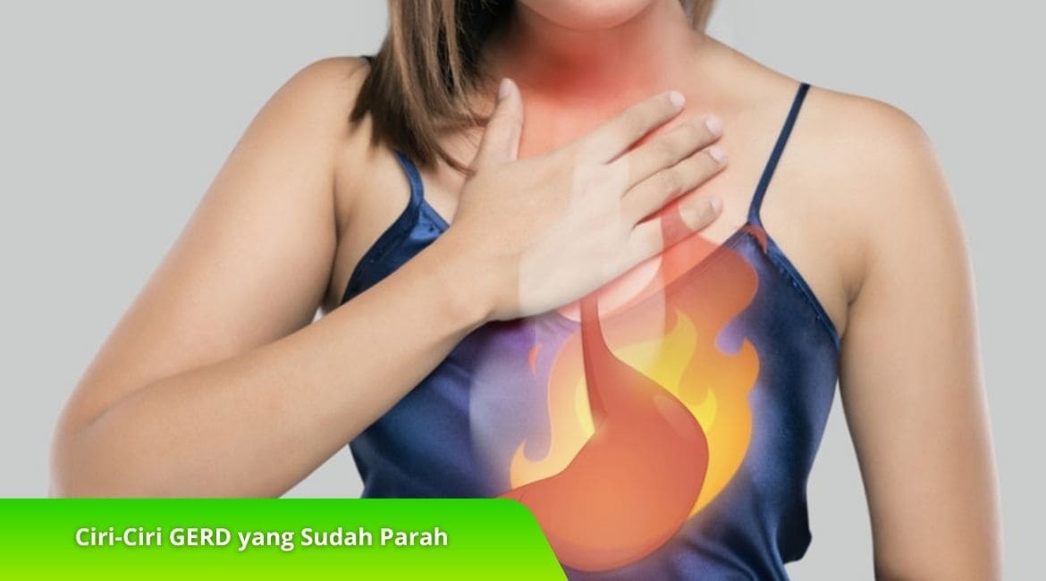 Kenali Ciri-Ciri GERD yang Sudah Parah, Cek di Sini! Kenali Ciri-Ciri GERD yang Sudah Parah, Cek di Sini!