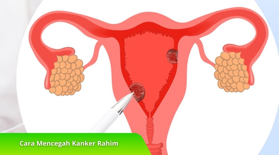 Ketahui 7 Cara Mencegah Kanker Rahim di Sini! Ketahui 7 Cara Mencegah Kanker Rahim di Sini!