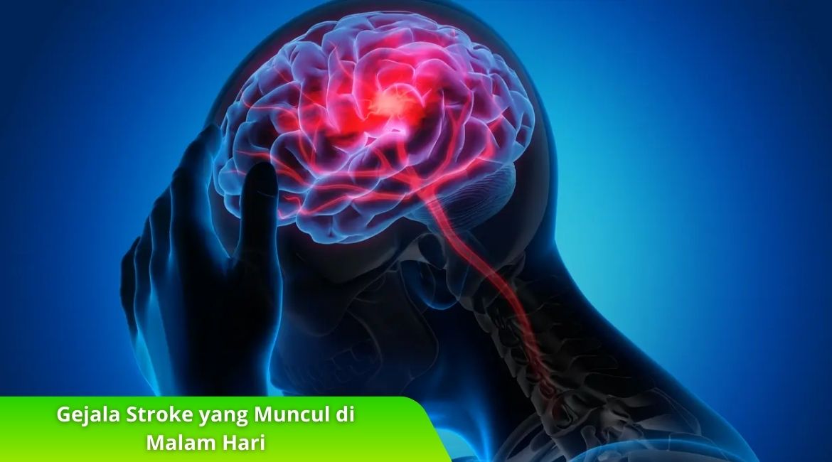 6 Gejala Stroke yang Muncul di Malam Hari, Cek di Sini! 6 Gejala Stroke yang Muncul di Malam Hari, Cek di Sini!