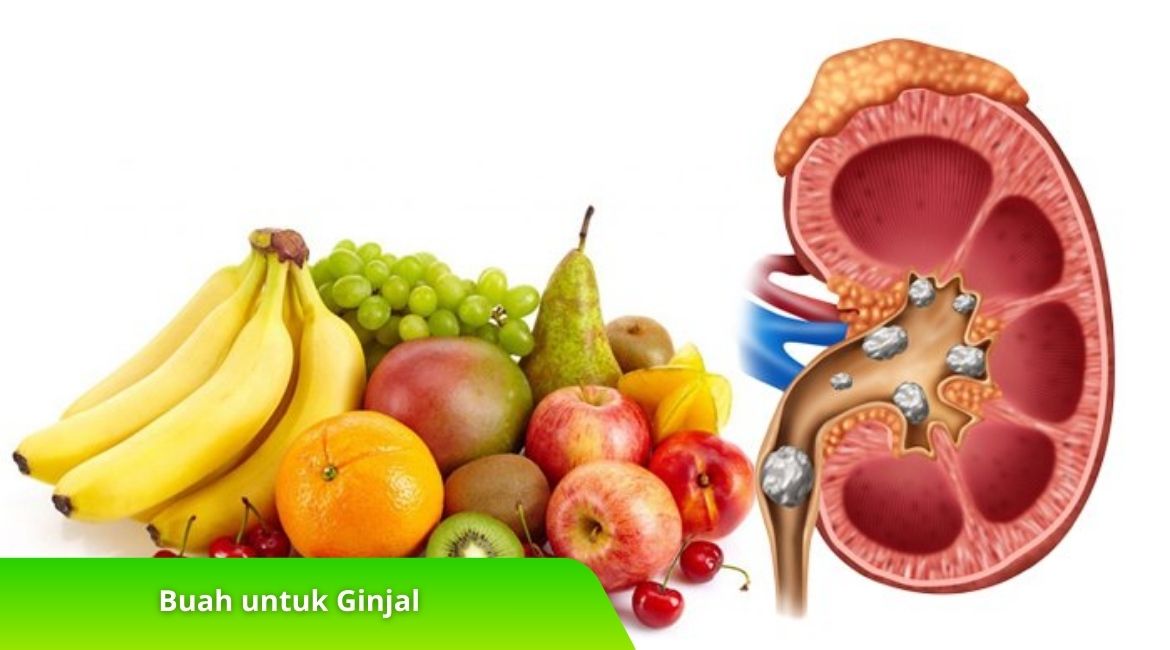Buah untuk Ginjal Pilihan Terbaik Mencegah Batu Ginjal Buah untuk Ginjal: Pilihan Terbaik Mencegah Batu Ginjal