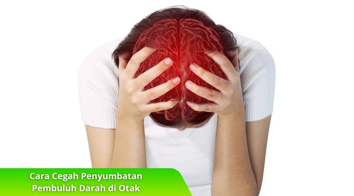Cara Cegah Penyumbatan Pembuluh Darah di Otak Tanpa Obat Cara Cegah Penyumbatan Pembuluh Darah di Otak Tanpa Obat