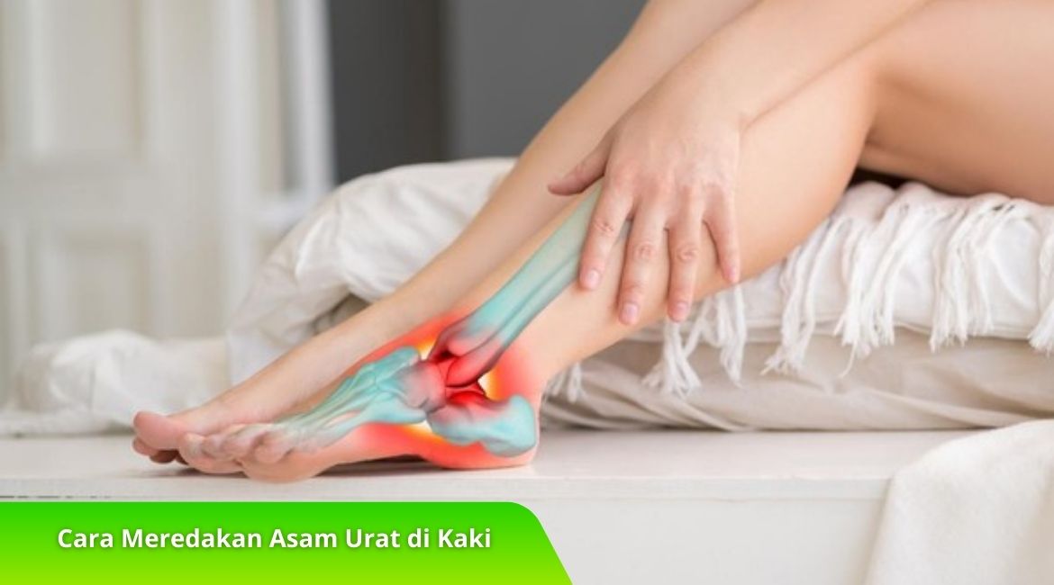 Cara Meredakan Asam Urat di Kaki dengan Obat Alami Cara Meredakan Asam Urat di Kaki dengan Obat Alami