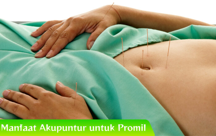 Terbukti! Manfaat Akupuntur untuk Promil dalam Studi Klinis