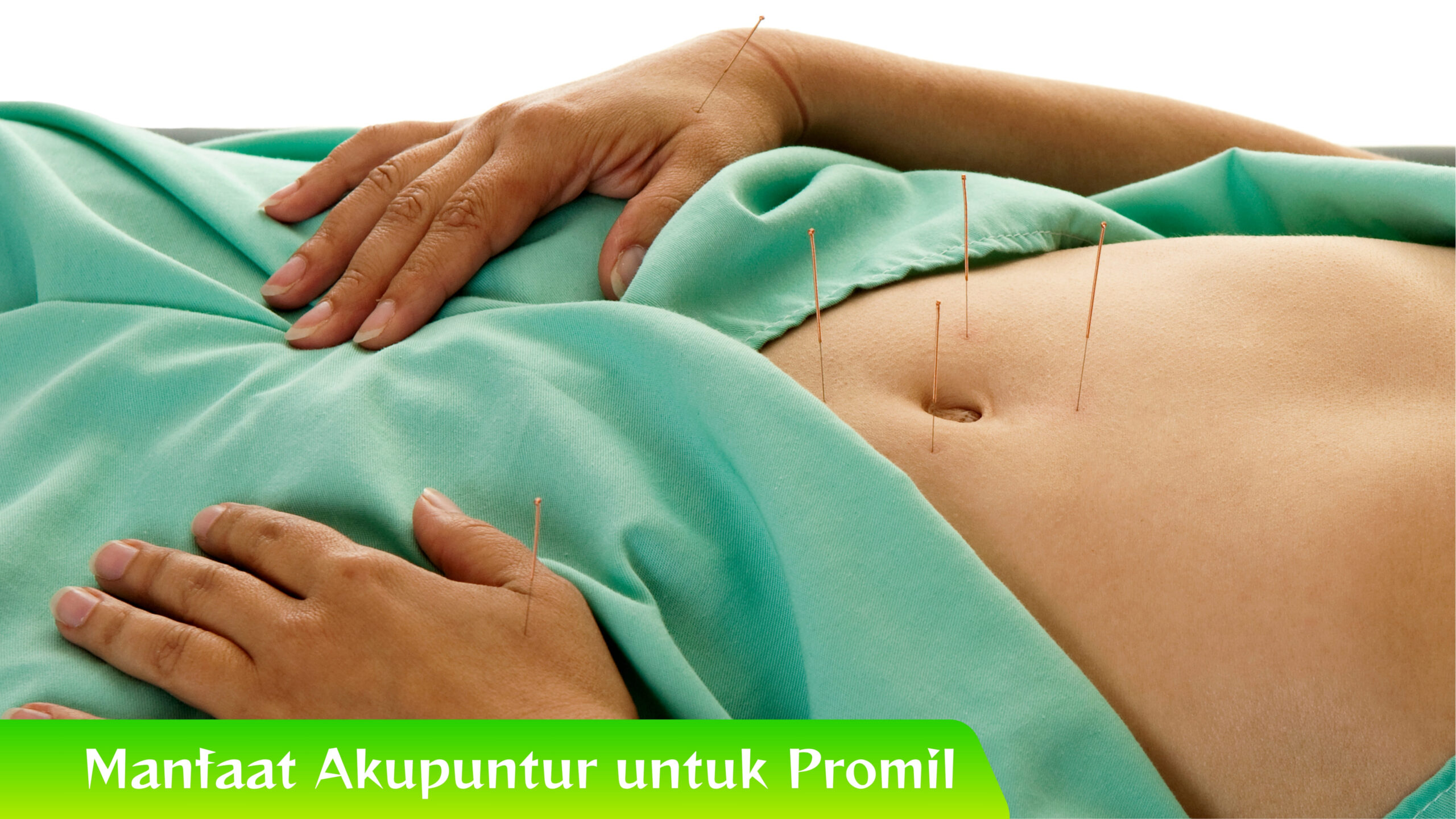 Manfaat Akupuntur untuk Promil Terbukti! Manfaat Akupuntur untuk Promil dalam Studi Klinis