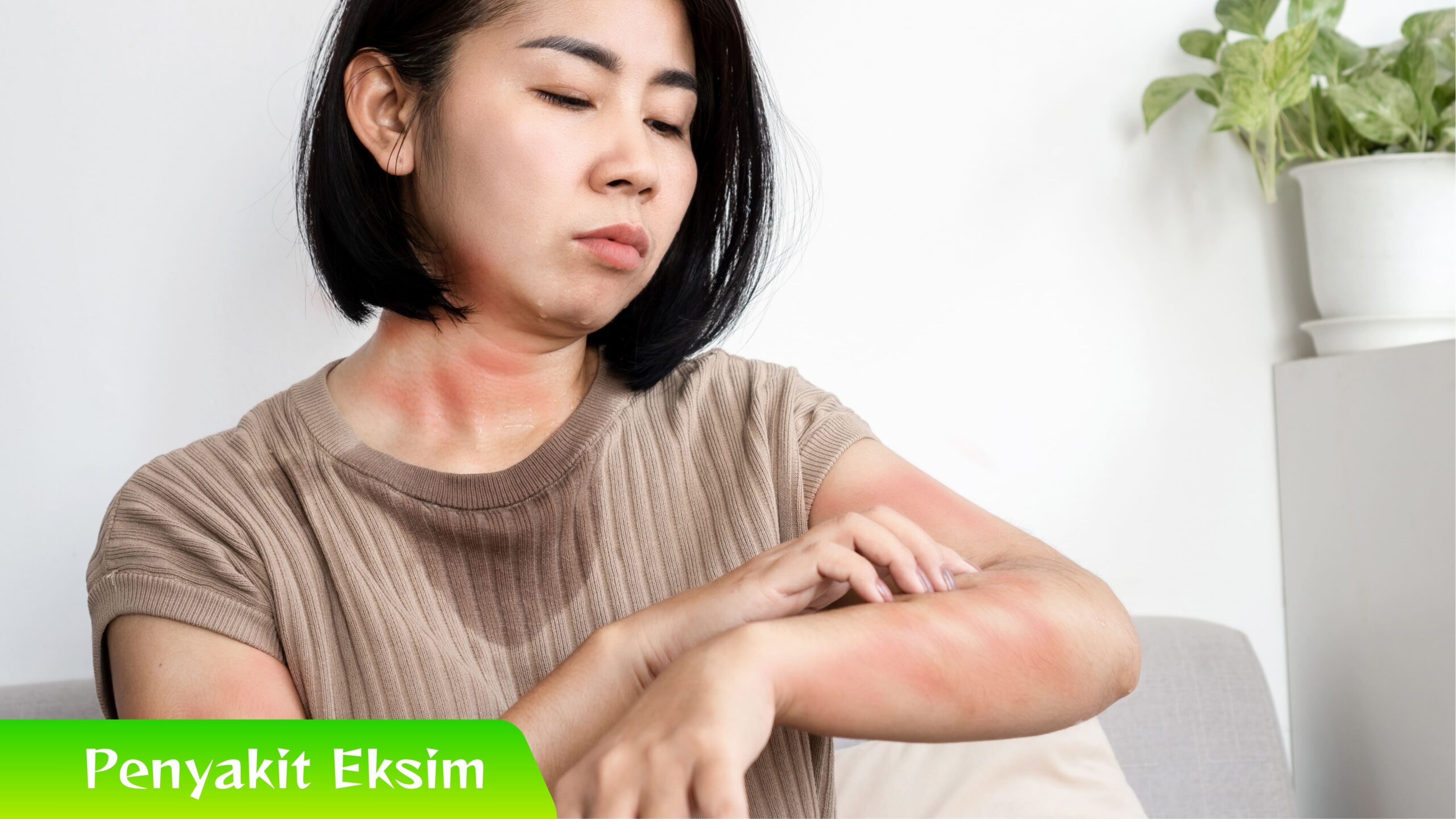 Penyakit Eksim Mengapa Penyakit Eksim Sering Kambuh? Ini Penjelasannya