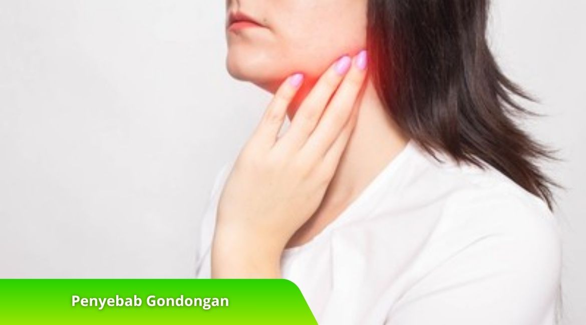 Penyebab Gondongan dan Komplikasi yang Mungkin Terjadi Penyebab Gondongan dan Komplikasi yang Mungkin Terjadi