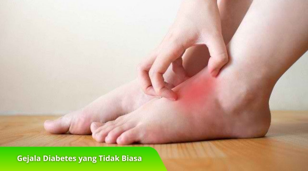 7 Gejala Diabetes yang Tidak Biasa, Apakah Anda Mengalaminya 7 Gejala Diabetes yang Tidak Biasa, Apakah Anda Mengalaminya?