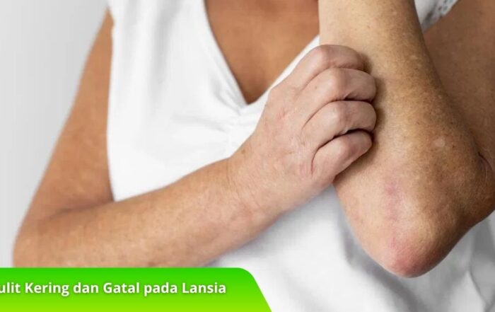 Mengenal Kulit Kering dan Gatal pada Lansia serta Penanganannya