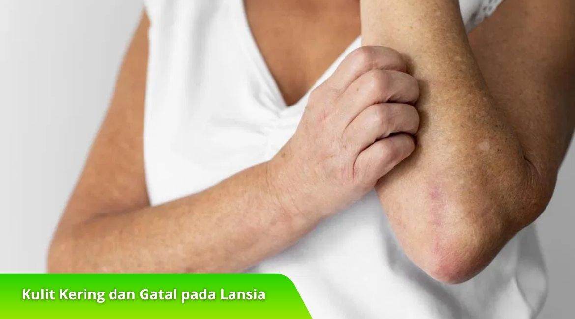 Mengenal Kulit Kering dan Gatal pada Lansia serta Penanganannya Mengenal Kulit Kering dan Gatal pada Lansia serta Penanganannya