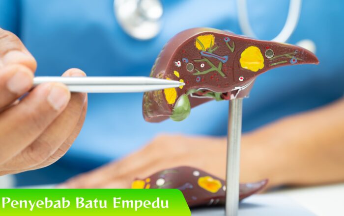 Gak Nyangka! Makanan Sehari-hari Jadi Penyebab Batu Empedu?