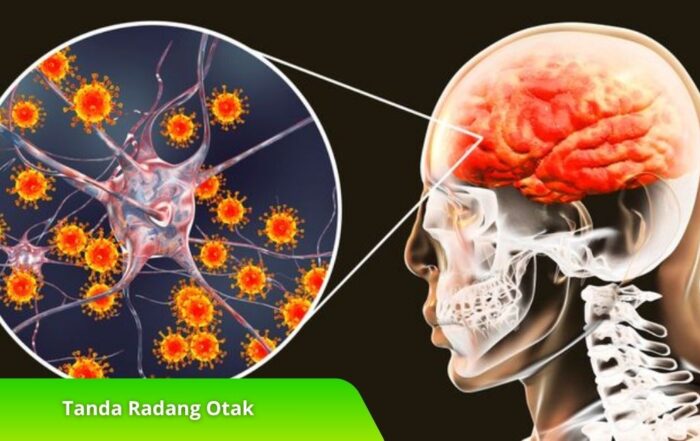 Tanda Radang Otak yang Harus Harus Diwaspadai Sejak Dini