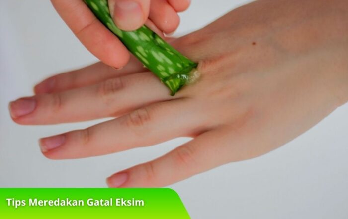 Tips Meredakan Gatal Eksim yang Membandel dengan Bahan Alami