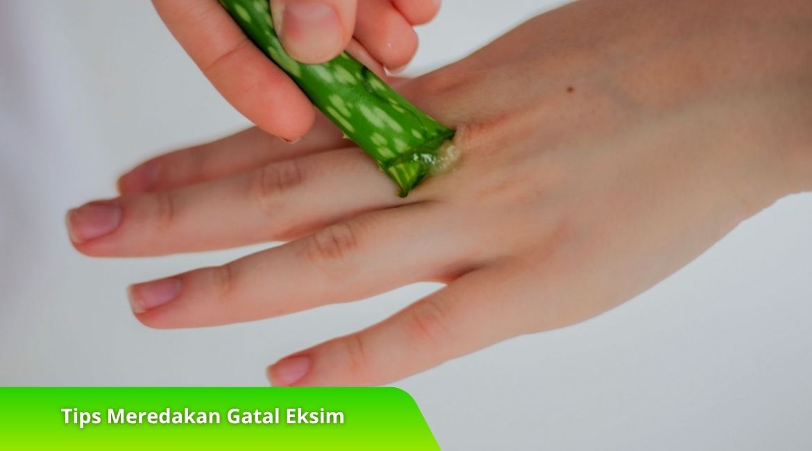 Tips Meredakan Gatal Eksim yang Membandel dengan Bahan Alami Tips Meredakan Gatal Eksim yang Membandel dengan Bahan Alami