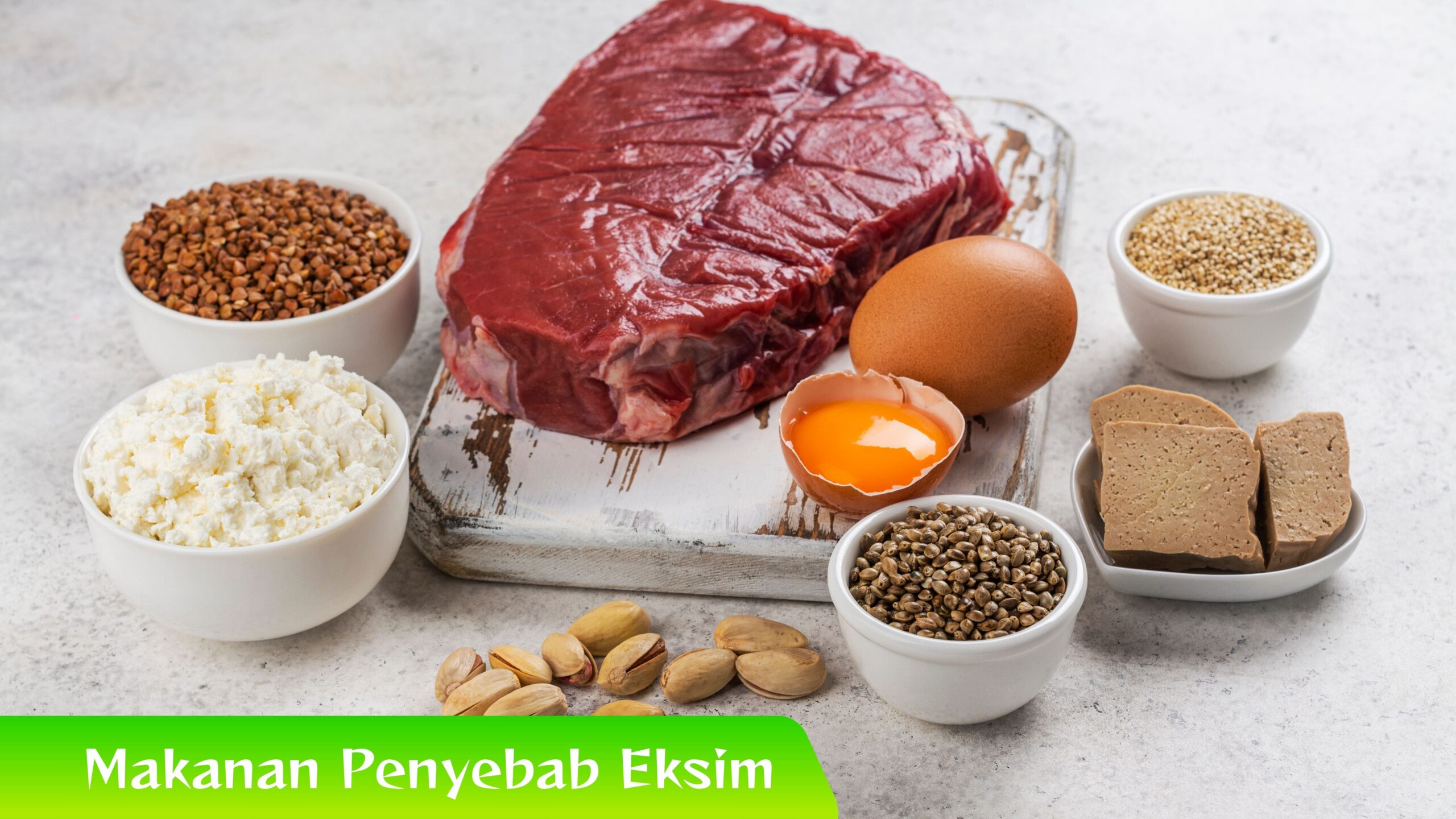Makanan Penyebab Eksim 6 Makanan Penyebab Eksim: Hindari Nomor 3!