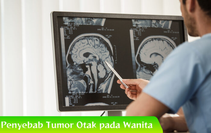 Terungkap! Ini Penyebab Tumor Otak pada Wanita Muda
