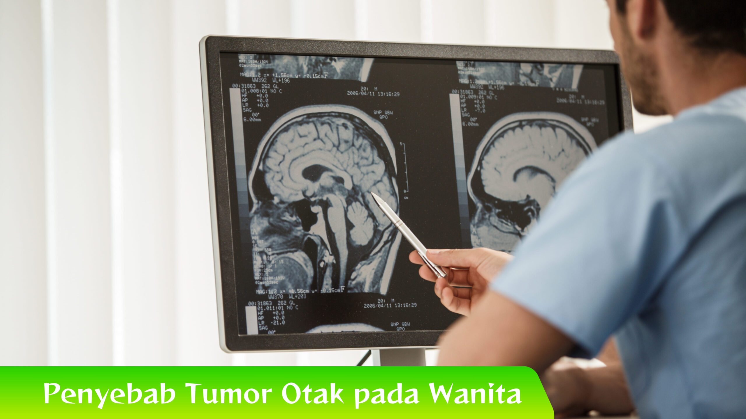 Penyebab Tumor Otak pada Wanita Terungkap! Ini Penyebab Tumor Otak pada Wanita Muda