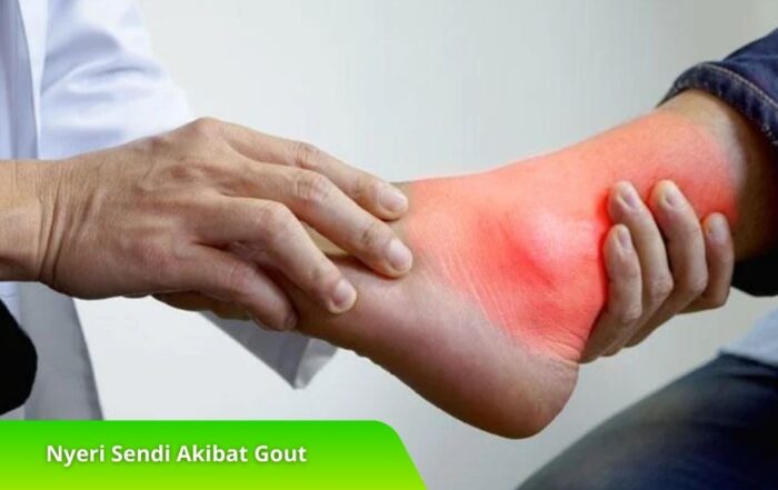 Nyeri Sendi Akibat Gout: Penyebab, Gejala, dan Cara Mengatasinya