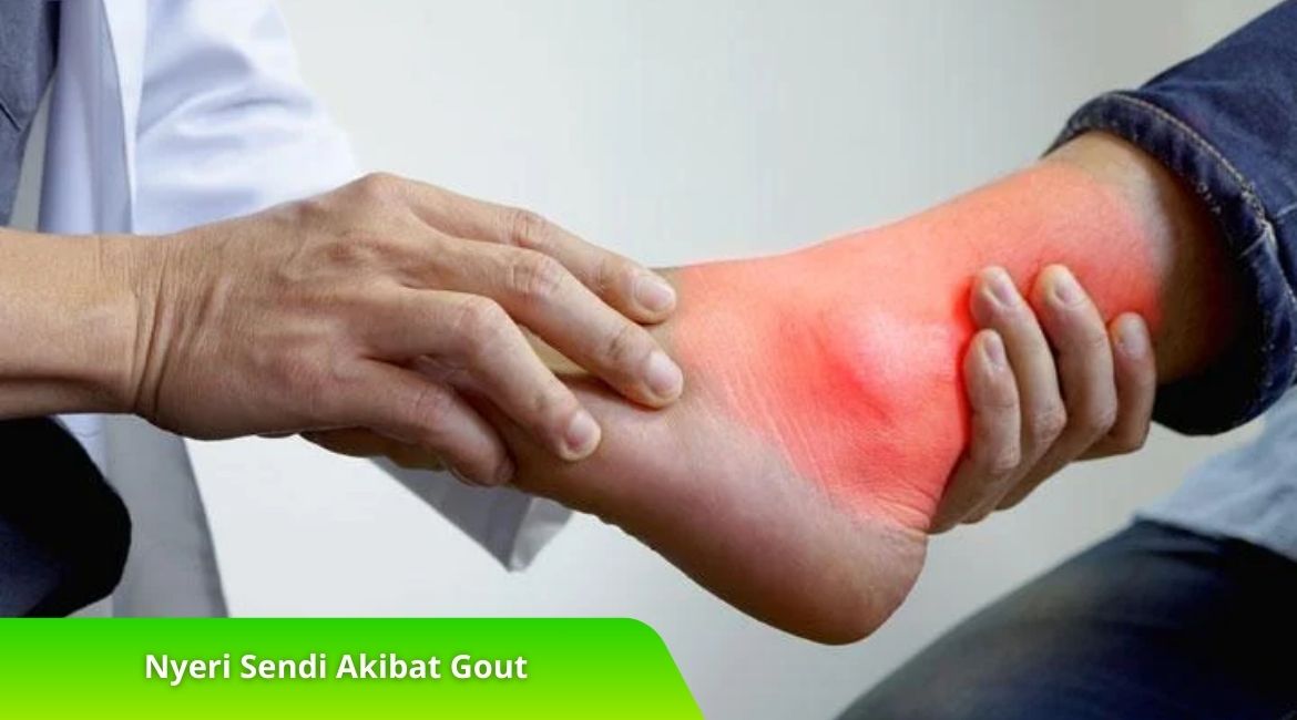Nyeri Sendi Akibat Gout: Penyebab, Gejala, dan Cara Mengatasinya